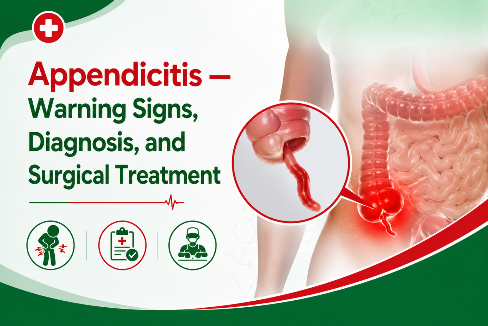 Appendicitis — Warning Signs, Diagnosis, and Surgical Treatment
